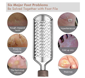 Foot Callus Remover